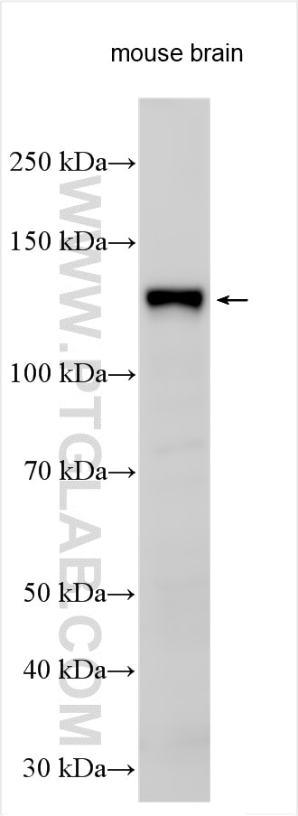 Western Blot (WB) analysis of various lysates using KIAA1468 Polyclonal antibody (18993-1-AP)