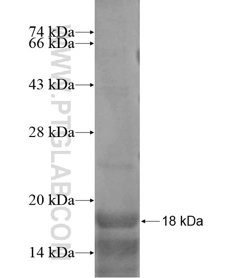 KIAA1486 fusion protein Ag19004 SDS-PAGE