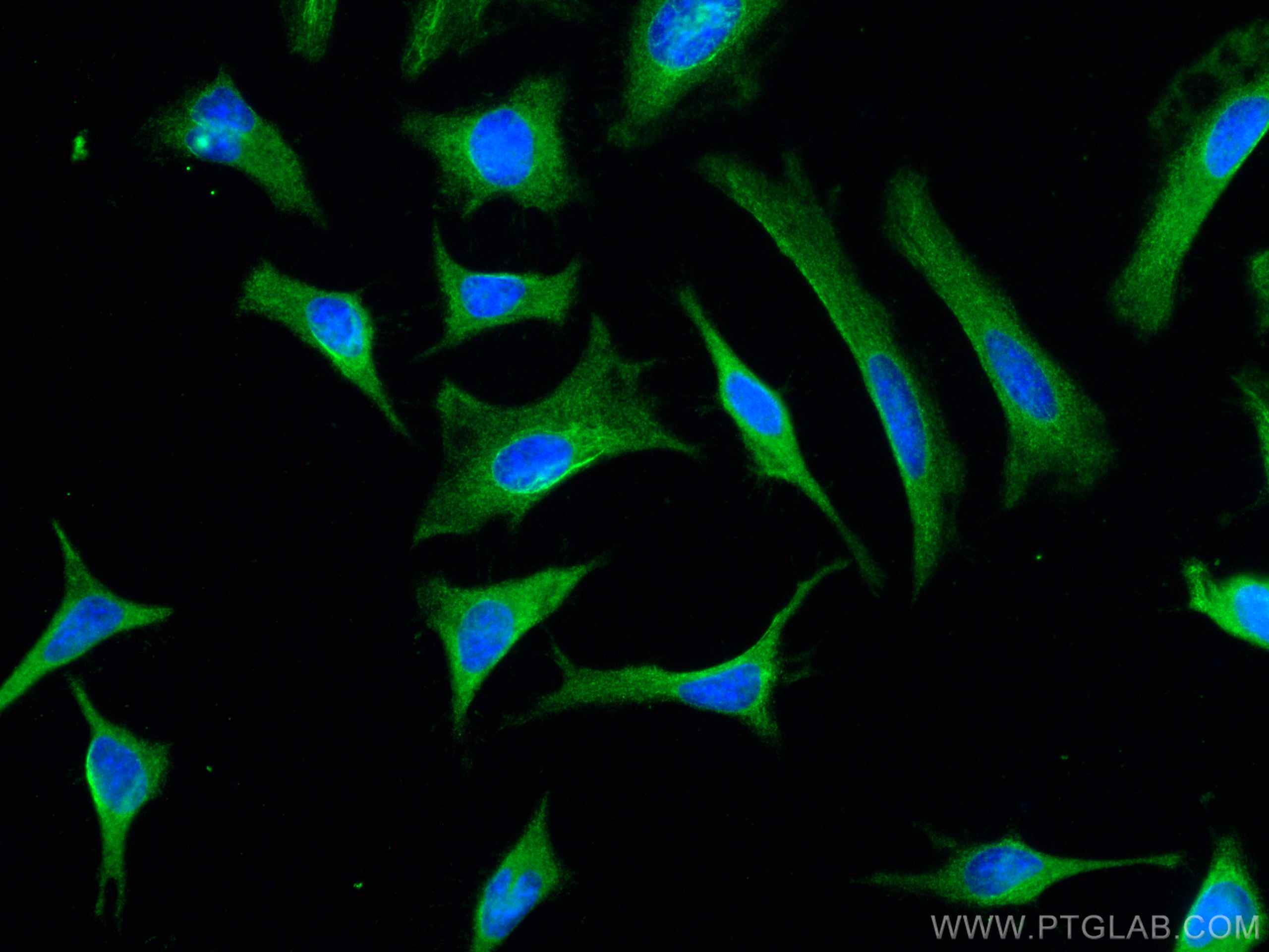 Immunofluorescence (IF) / fluorescent staining of HeLa cells using CIP2A Monoclonal antibody (67843-1-Ig)