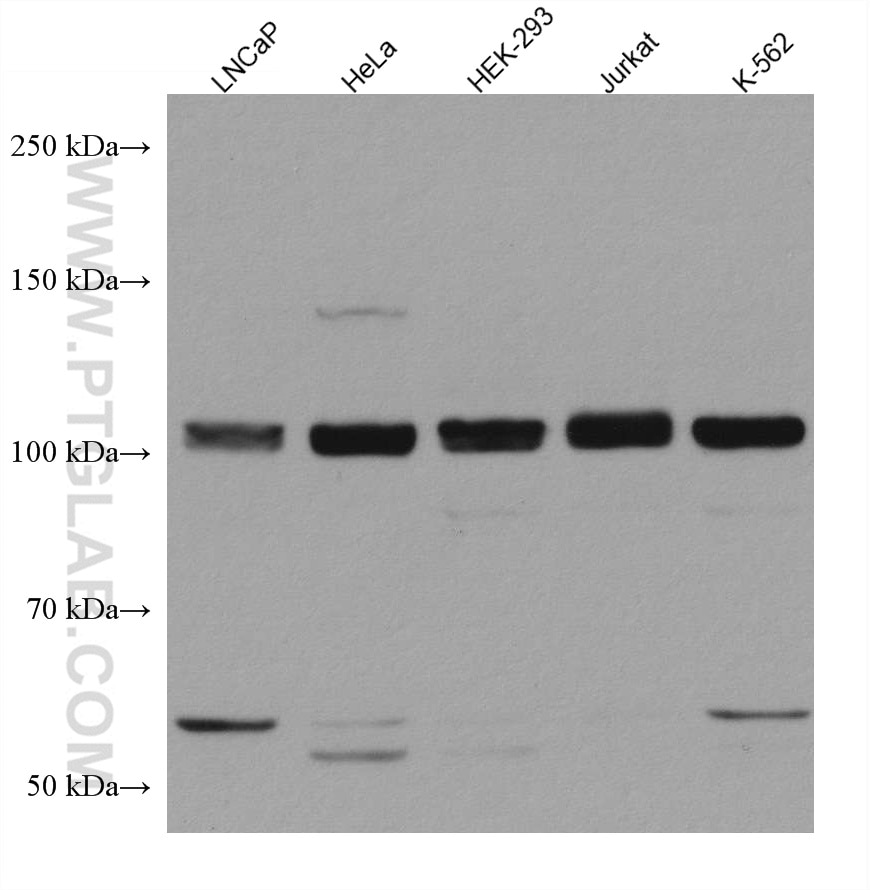 Western Blot (WB) analysis of various lysates using CIP2A Monoclonal antibody (67843-1-Ig)