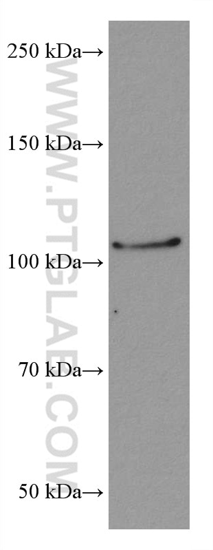 Western Blot (WB) analysis of PC-12 cells using CIP2A Monoclonal antibody (67843-1-Ig)