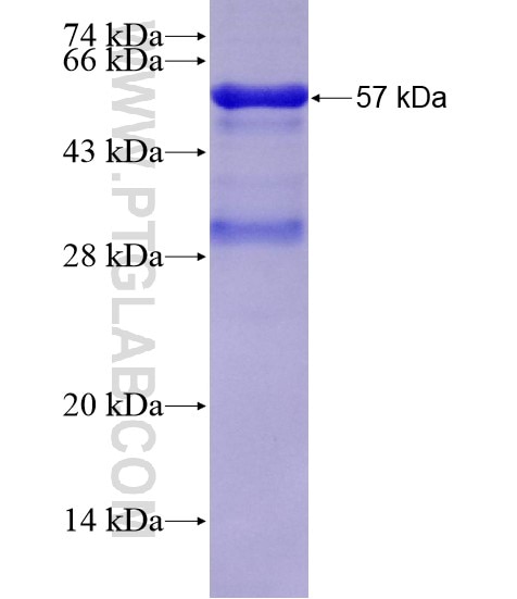 KIAA1524 fusion protein Ag19597 SDS-PAGE