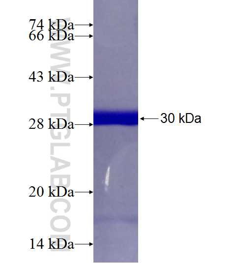 KIAA1524 fusion protein Ag19598 SDS-PAGE