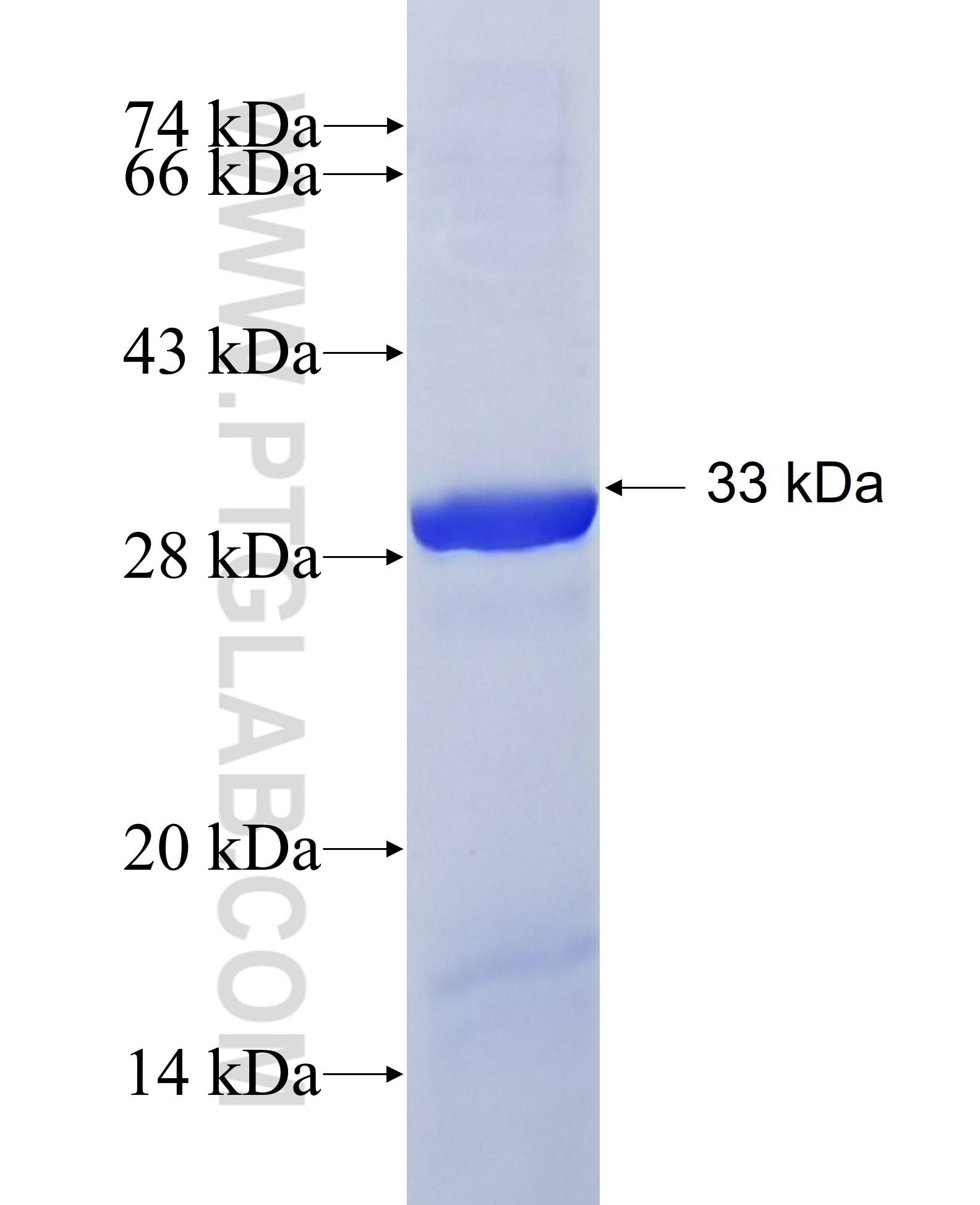 KIAA1524 fusion protein Ag19598 SDS-PAGE