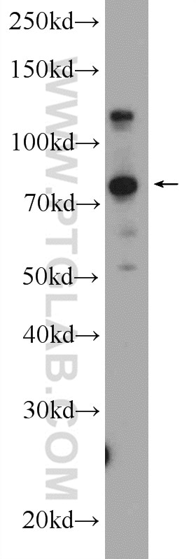 Western Blot (WB) analysis of Raji cells using KIAA1530 Polyclonal antibody (25054-1-AP)