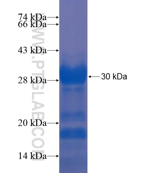 KIAA1530 fusion protein Ag21868 SDS-PAGE