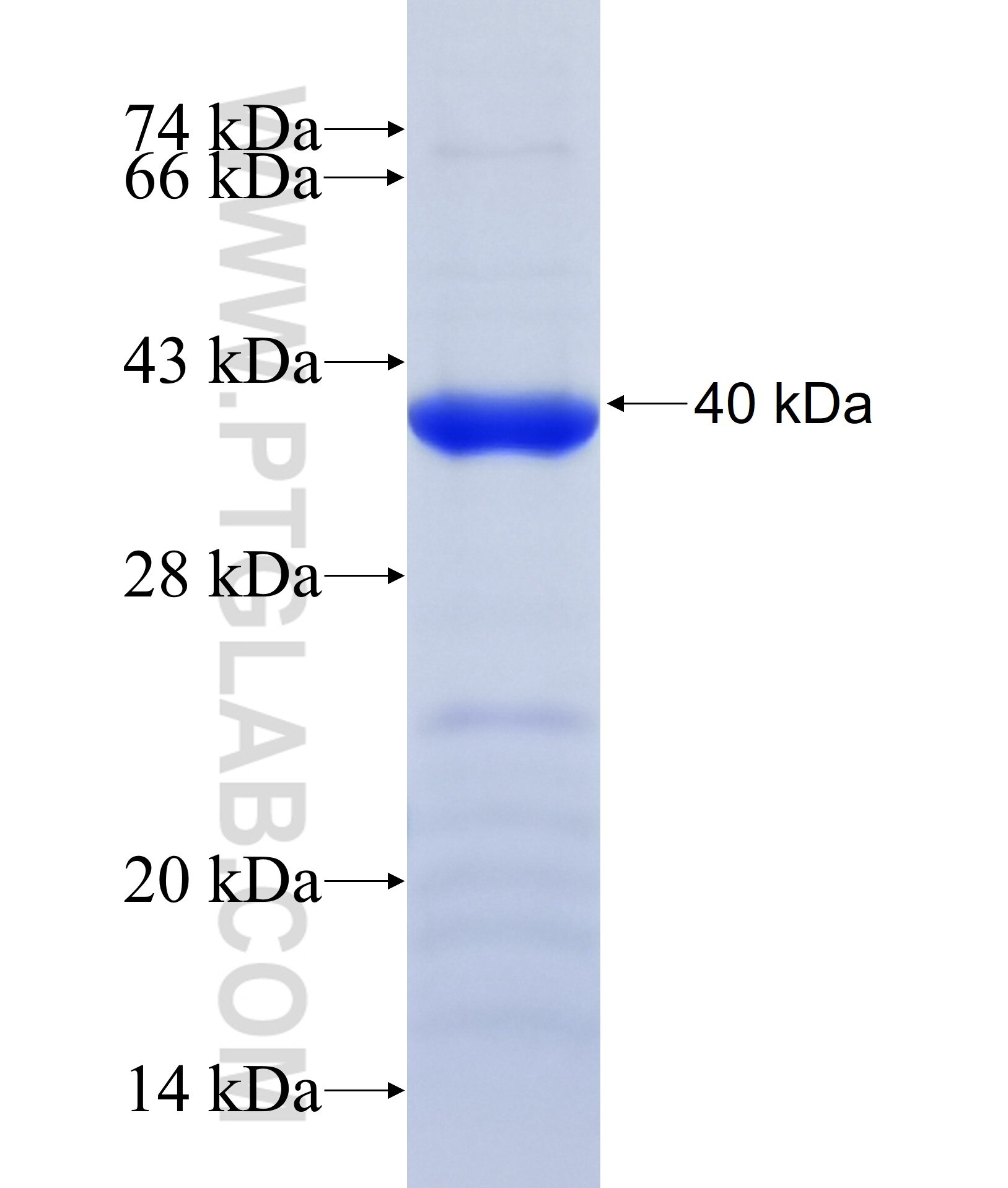 KIAA1539 fusion protein Ag36975 SDS-PAGE
