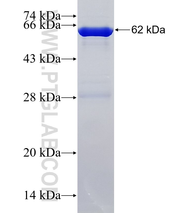 KIAA1586 fusion protein Ag36038 SDS-PAGE