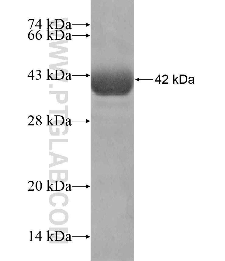 KIAA1586 fusion protein Ag18547 SDS-PAGE