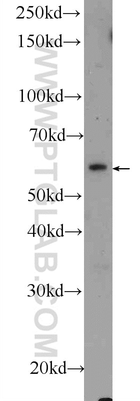 Western Blot (WB) analysis of rat brain tissue using Shootin 1 Polyclonal antibody (24383-1-AP)