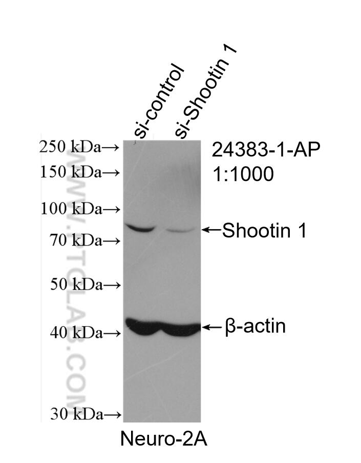 Western Blot (WB) analysis of Neuro-2a cells using Shootin 1 Polyclonal antibody (24383-1-AP)