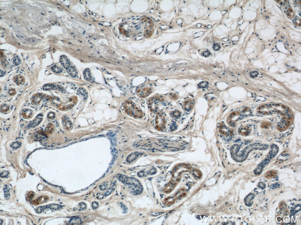 Immunohistochemistry (IHC) staining of human skin tissue using NCKAP5L Polyclonal antibody (21392-1-AP)