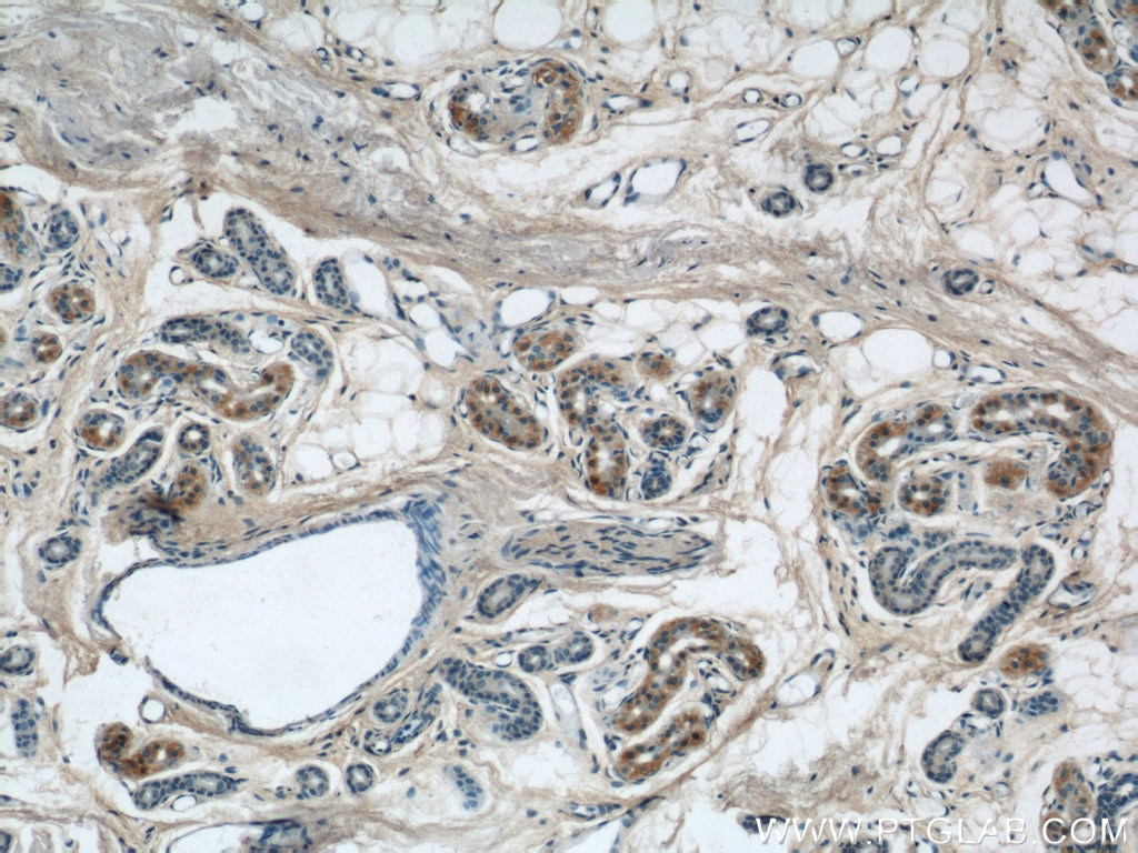 IHC staining of human skin using 21392-1-AP