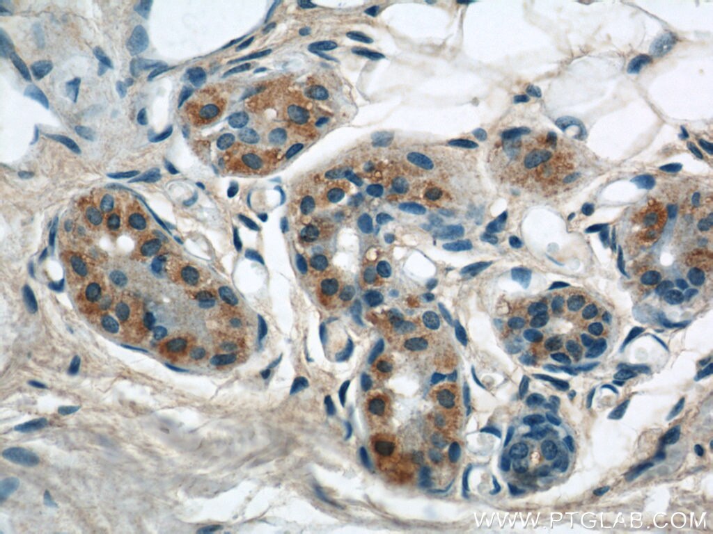 Immunohistochemistry (IHC) staining of human skin tissue using NCKAP5L Polyclonal antibody (21392-1-AP)