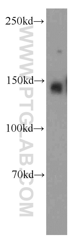 Western Blot (WB) analysis of HeLa cells using NCKAP5L Polyclonal antibody (21392-1-AP)