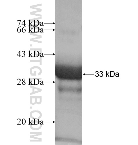 KIAA1602 fusion protein Ag16050 SDS-PAGE