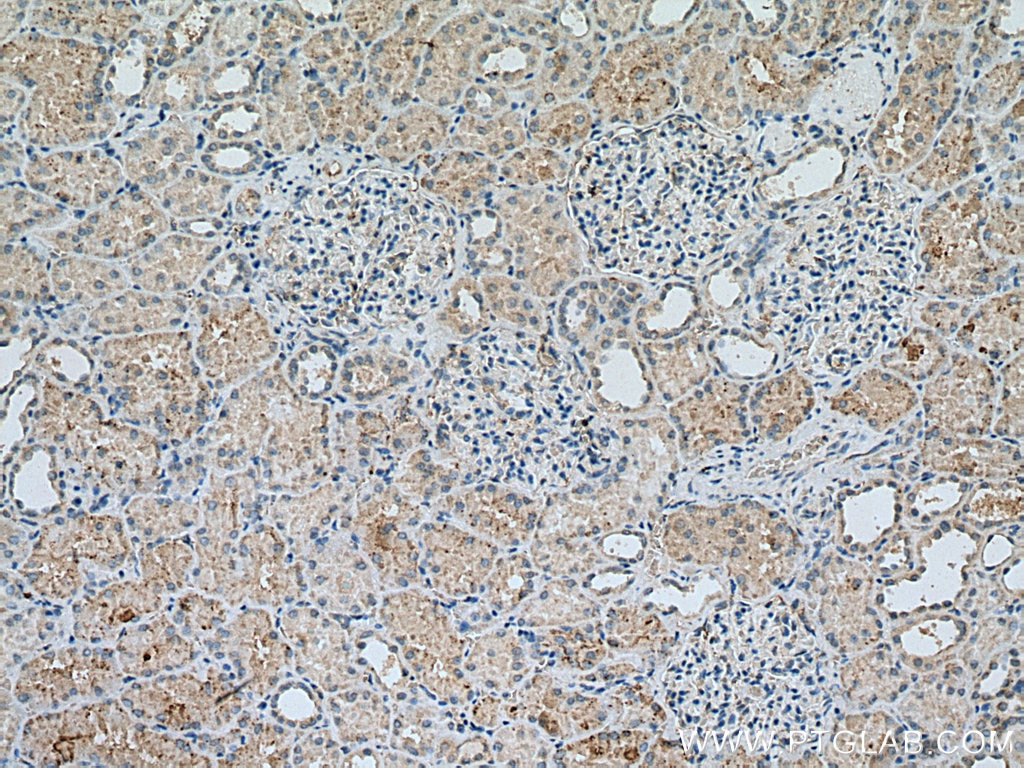 Immunohistochemistry (IHC) staining of human kidney tissue using EPG5 Polyclonal antibody (27666-1-AP)