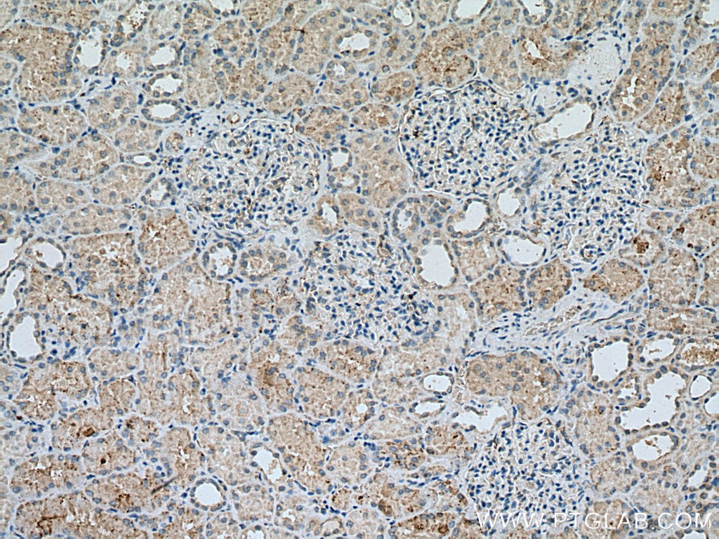 Immunohistochemistry (IHC) staining of human kidney tissue using EPG5 Polyclonal antibody (27666-1-AP)