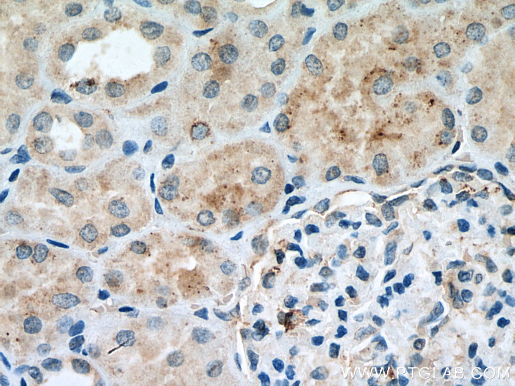 Immunohistochemistry (IHC) staining of human kidney tissue using EPG5 Polyclonal antibody (27666-1-AP)