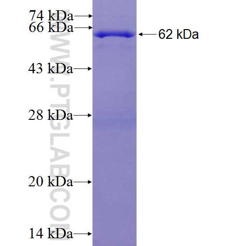 KIAA1632 fusion protein Ag24801 SDS-PAGE