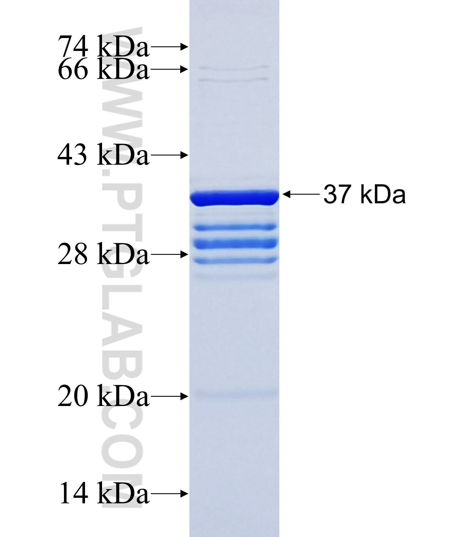 KIAA1688 fusion protein Ag37238 SDS-PAGE KIAA1688 fusion protein Ag37238 SDS-PAGE