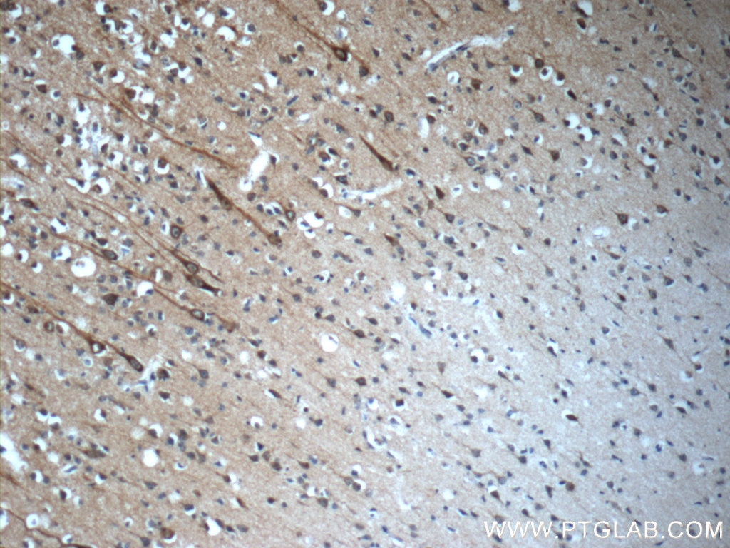 Immunohistochemistry (IHC) staining of human brain tissue using CEP44 Polyclonal antibody (24457-1-AP)