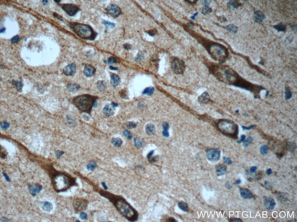 Immunohistochemistry (IHC) staining of human brain tissue using CEP44 Polyclonal antibody (24457-1-AP)