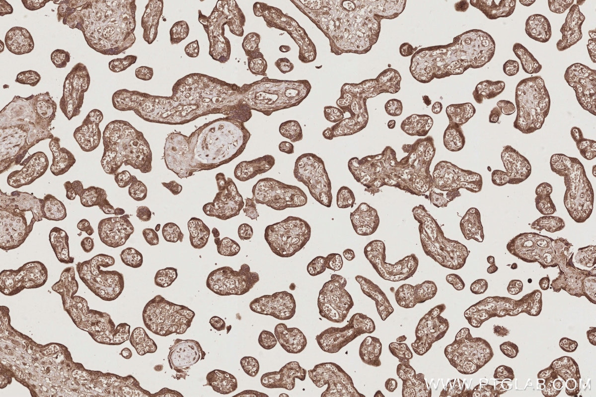IHC staining of human placenta using 24457-1-AP Immunohistochemistry (IHC) staining of human placenta tissue using CEP44 Polyclonal antibody (24457-1-AP)