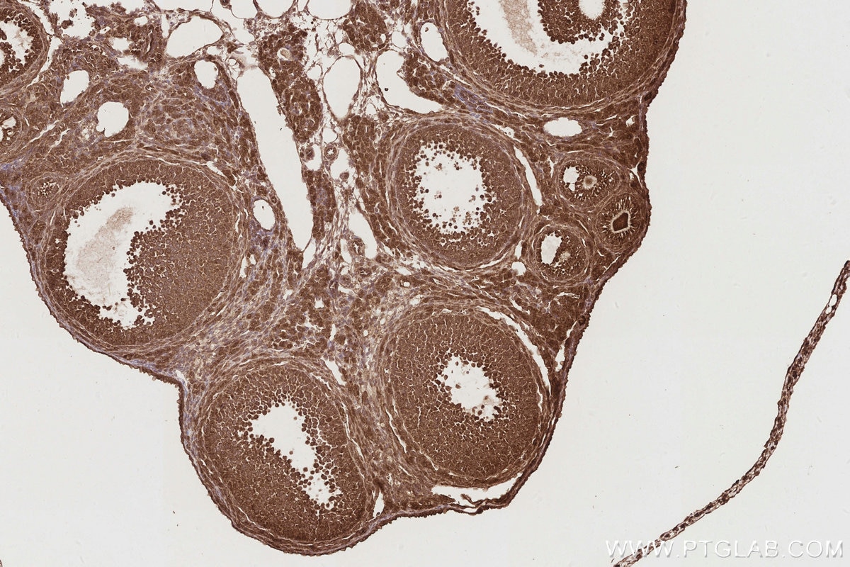 IHC staining of mouse ovary using 24457-1-AP Immunohistochemistry (IHC) staining of mouse ovary tissue using CEP44 Polyclonal antibody (24457-1-AP)
