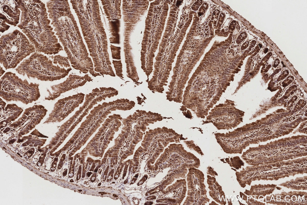 IHC staining of mouse small intestine using 24457-1-AP Immunohistochemistry (IHC) staining of mouse small intestine tissue using CEP44 Polyclonal antibody (24457-1-AP)