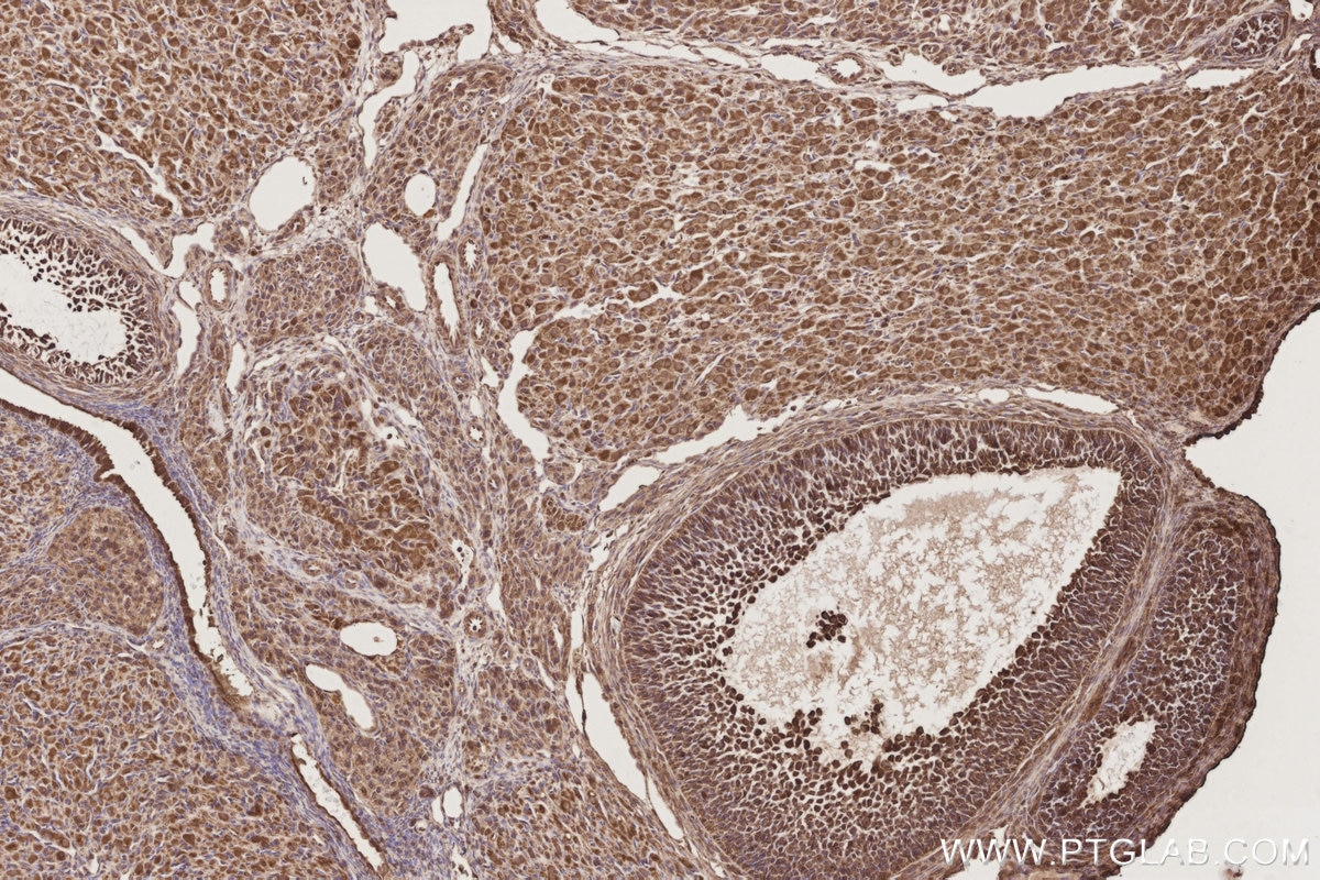 IHC staining of rat ovary using 24457-1-AP Immunohistochemistry (IHC) staining of rat ovary tissue using CEP44 Polyclonal antibody (24457-1-AP)