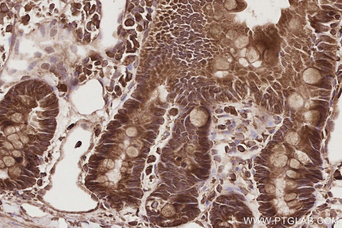IHC staining of rat small intestine using 24457-1-AP Immunohistochemistry (IHC) staining of rat small intestine tissue using CEP44 Polyclonal antibody (24457-1-AP)