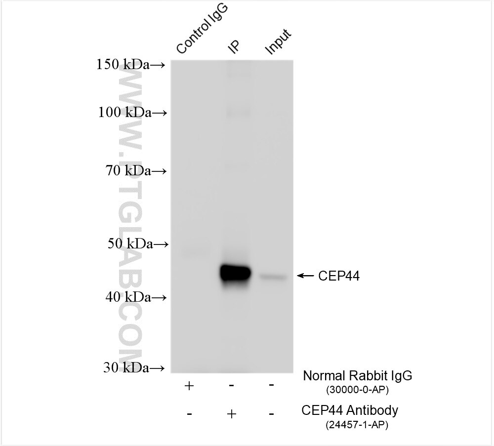 Immunoprecipitation (IP) experiment of HeLa cells using CEP44 Polyclonal antibody (24457-1-AP)