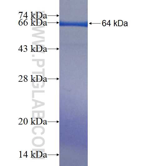 KIAA1712 fusion protein Ag19961 SDS-PAGE