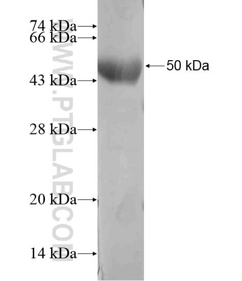 KIAA1712 fusion protein Ag20022 SDS-PAGE