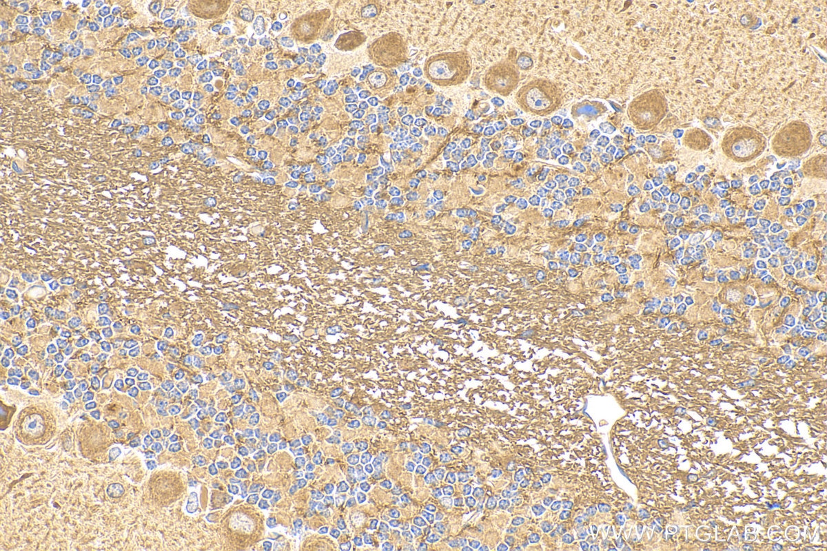 Immunohistochemistry (IHC) staining of mouse cerebellum tissue using KIAA1715 Polyclonal antibody (30857-1-AP)