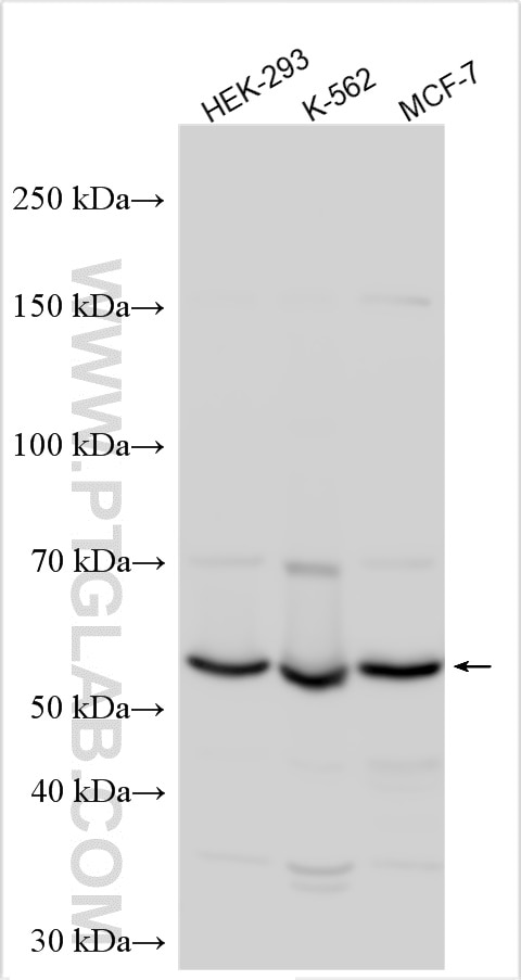 Western Blot (WB) analysis of various lysates using KIAA1715 Polyclonal antibody (30857-1-AP)