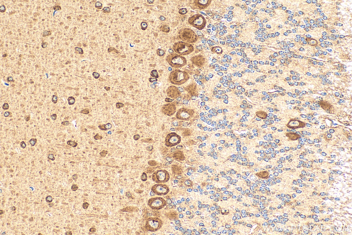 Immunohistochemistry (IHC) staining of mouse cerebellum tissue using KIAA1715 Recombinant antibody (83418-4-RR)
