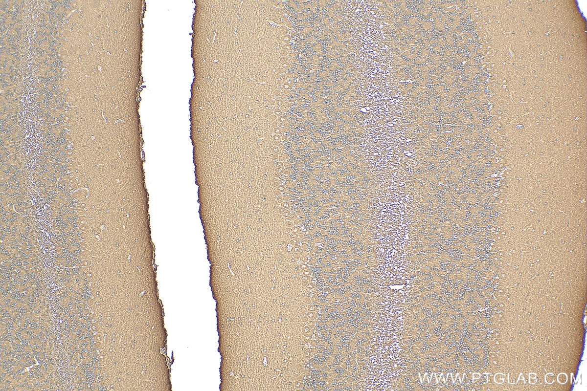 Immunohistochemistry (IHC) staining of mouse cerebellum tissue using KIAA1715 Recombinant antibody (83418-5-RR)