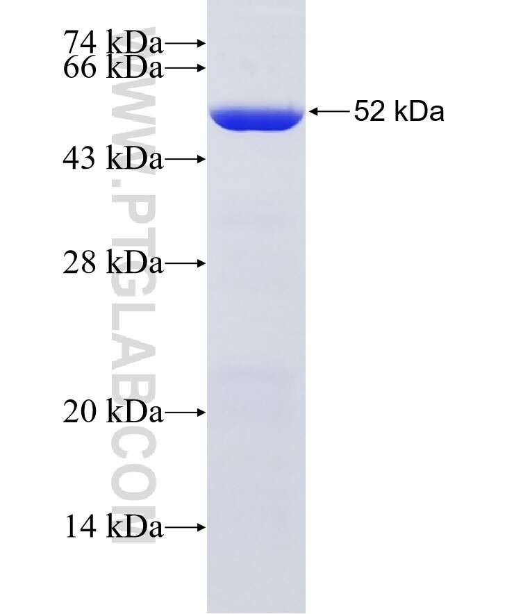 KIAA1715 fusion protein Ag33996 SDS-PAGE