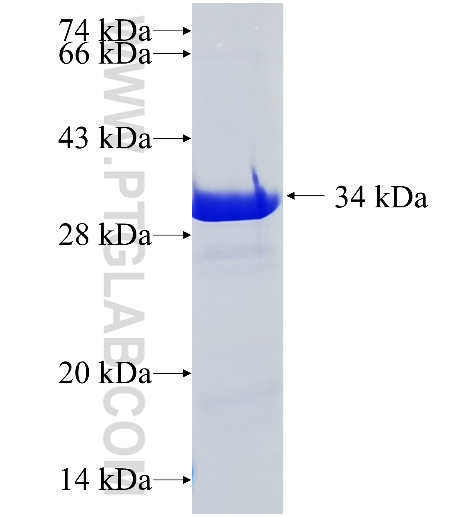 KIAA1715 fusion protein Ag37220 SDS-PAGE