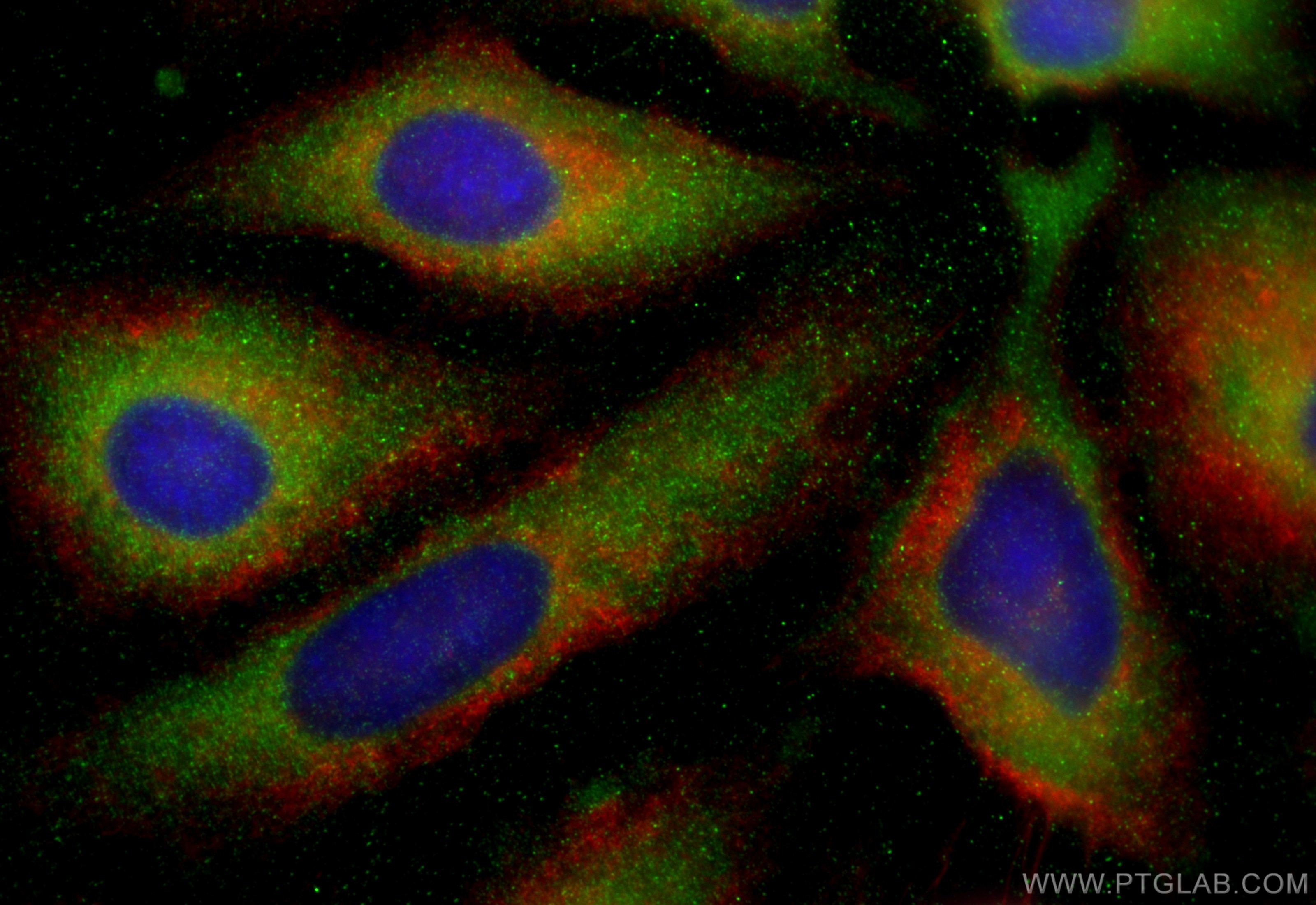 Immunofluorescence (IF) / fluorescent staining of HeLa cells using KIAA1797 Polyclonal antibody (30140-1-AP)