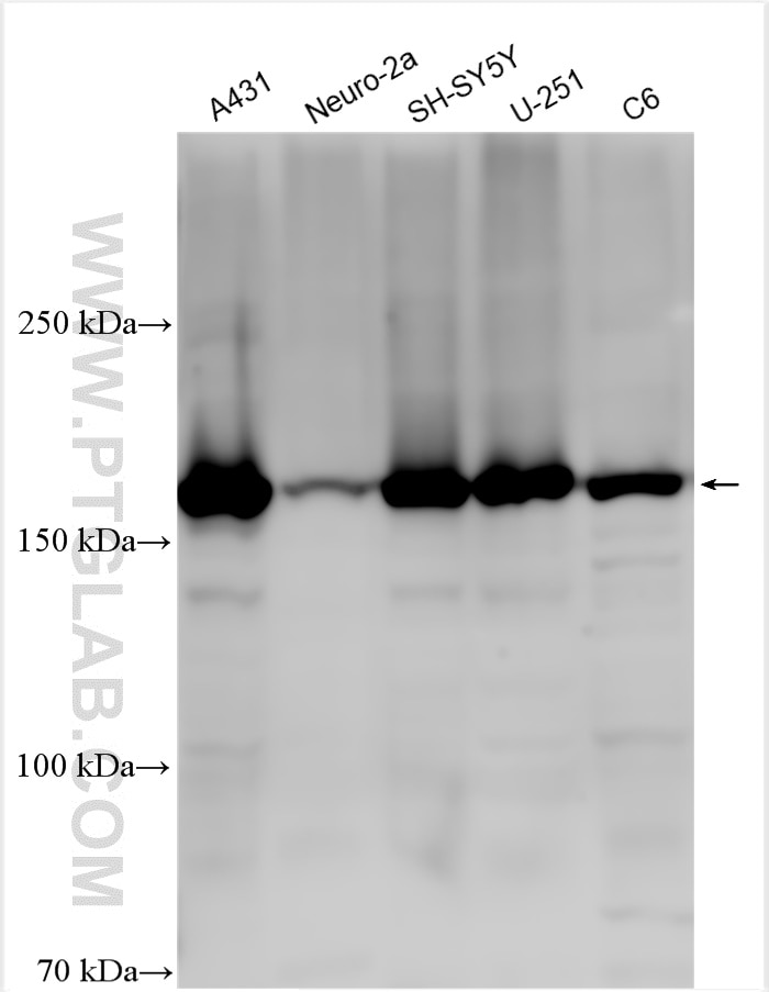 Western Blot (WB) analysis of various lysates using KIAA1797 Polyclonal antibody (30140-1-AP)