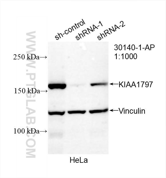 Western Blot (WB) analysis of HeLa cells using KIAA1797 Polyclonal antibody (30140-1-AP)