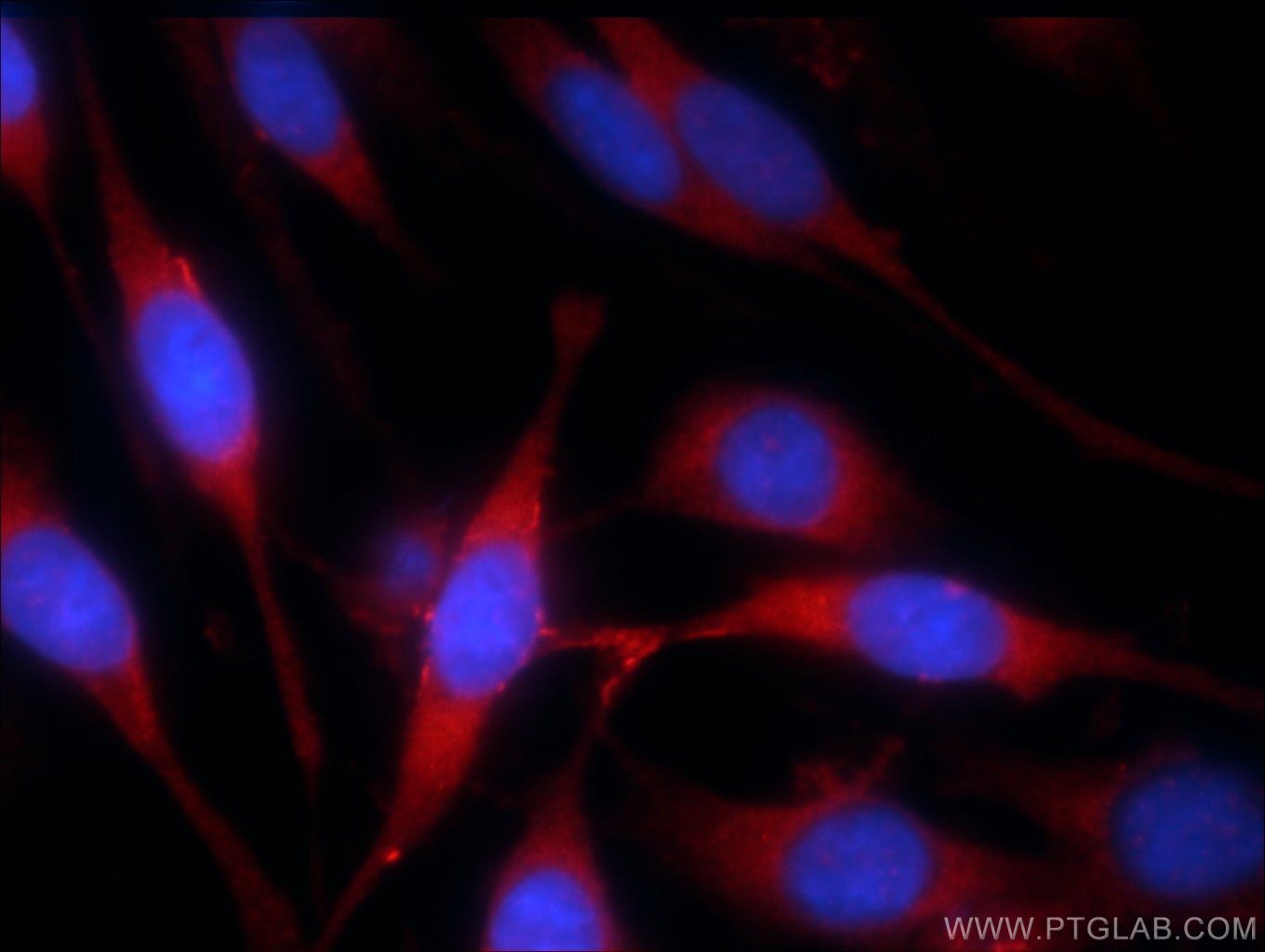 Immunofluorescence (IF) / fluorescent staining of C6 cells using MLK4 Polyclonal antibody (24395-1-AP)