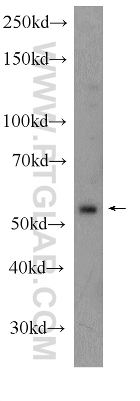 Western Blot (WB) analysis of HeLa cells using MLK4 Polyclonal antibody (24395-1-AP)