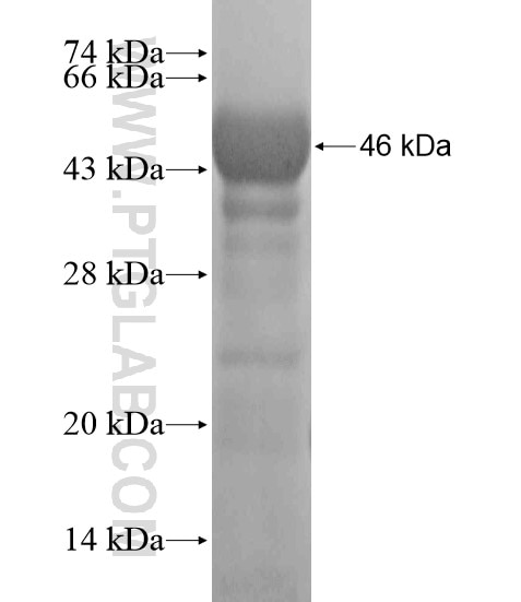 KIAA1804 fusion protein Ag18904 SDS-PAGE