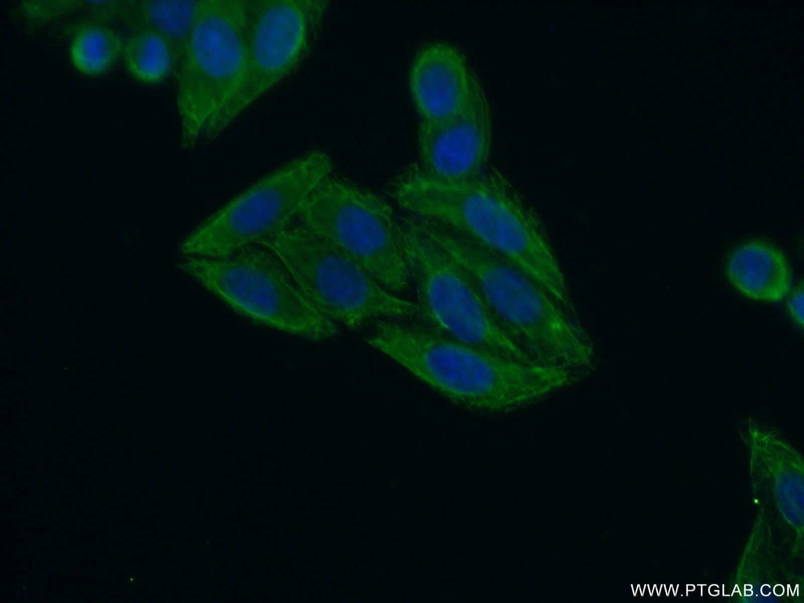 Immunofluorescence (IF) / fluorescent staining of HepG2 cells using KIAA1984 Polyclonal antibody (20945-1-AP)