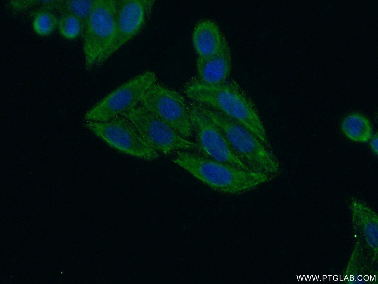 IF Staining of HepG2 using 20945-1-AP