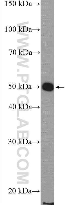 Western Blot (WB) analysis of HeLa cells using KIAA1984 Polyclonal antibody (20945-1-AP)